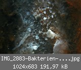 IMG_2883-Bakterien-in-der-H.jpg